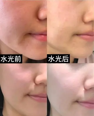 マツエク・マツパ aliaハーブ水光店 エステティシャン募集のエステ・リラクイメージ