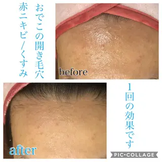 ミディアム カラー パーマ ヘアアレンジ キッズ ネイル マツエク・マツパ EnsorClair 代表 野口真央のエステ・リラクイメージ