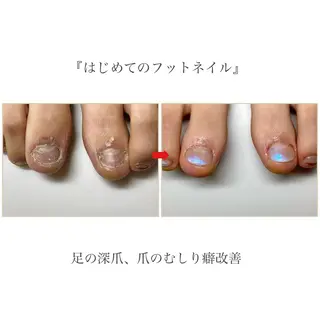 ネイル ネイルサロン アリュームのネイルデザイン