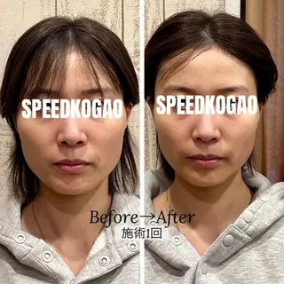 小顔矯正Speed KOGAO渋谷本店のエステ・リラクイメージ