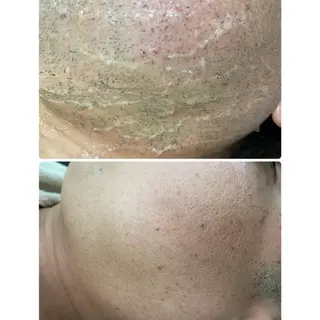 脱毛専門サロン Elixir　加須店のエステ・リラクイメージ