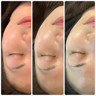 luana beauty所属・kana ハーブピーリング🌿のエステ・リラクイメージ