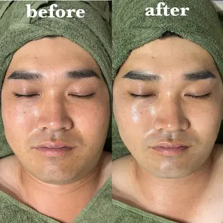 メンズ 肌質改善＆脱毛 【M Mondo】のエステ・リラクイメージ