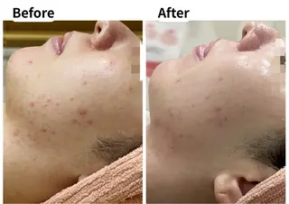 美肌脱毛サロン muroのエステ・リラクイメージ