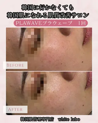 ホワイトラボ梅田 ｜毛穴・韓国肌管理のエステ・リラクイメージ