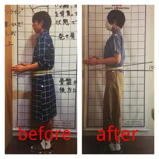 リフトアップ・たるみ ☆美容鍼小顔矯正のその他イメージ