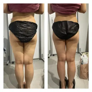 部分痩せ♥️小顔専門 MIKUのエステ・リラクイメージ