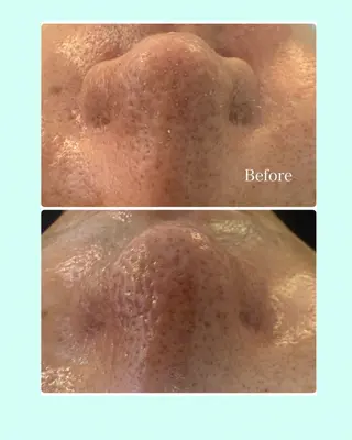 NICORI　小顔&肌質改善専門店所属・小顔＆肌質改善 NICORIのエステ・リラクイメージ