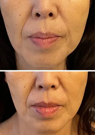 耳ツボ/体質改善/ 温活La mer月島のその他イメージ