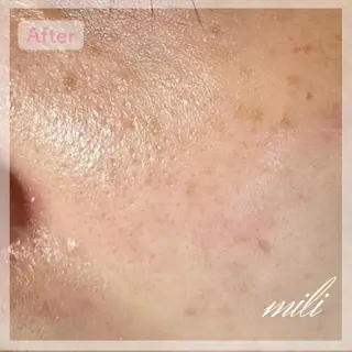 【毛穴ケア専門店✨】 mili 須藤歩華のエステ・リラクイメージ
