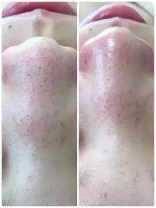 トータルエステサロン Tiaraのエステ・リラクイメージ