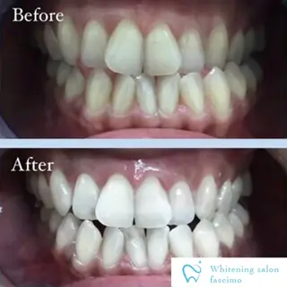 ホワイトニングサロン fascimo新座店のその他イメージ