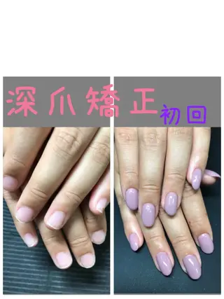 ネイル 仲谷 つかさのエステ・リラクイメージ