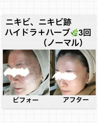 ハーブピーリング専門 MOKAのエステ・リラクイメージ