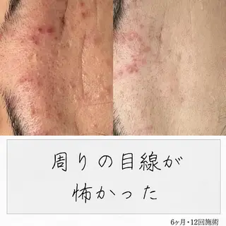 ニキビ経験者が施術 する専門サロン🌻のエステ・リラクイメージ