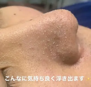 Lien オーナー 山口智嘉のエステ・リラクイメージ