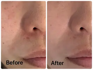 facial salon D 吉沢のエステ・リラクイメージ