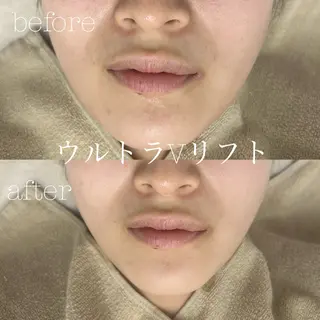 フェイシャルサロン CHIARA 荒田のエステ・リラクイメージ