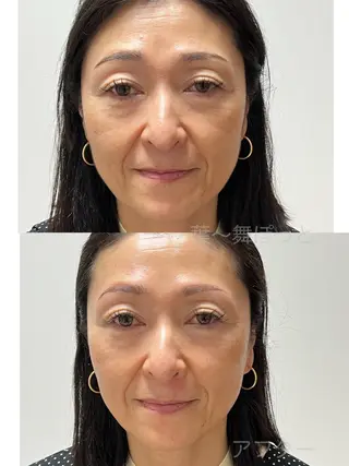 うえつま ふみえのエステ・リラクイメージ