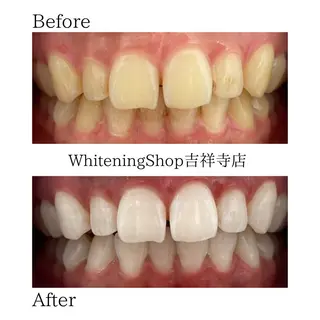 ホワイトニングショッ 吉祥寺2号店のその他イメージ