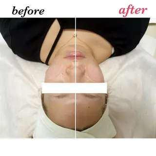 デ・アイム鴻巣所属・素肌美づくりサロン 《鴻巣・熊谷》のエステ・リラクイメージ