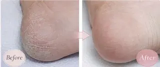 ネイル 野島 亜美のネイルデザイン