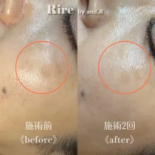 実方 梨々花のエステ・リラクイメージ