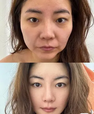 マツエク・マツパ aliaハーブ水光店 エステティシャン募集のエステ・リラクイメージ