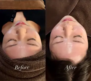 脱毛／肌質改善 《ulula~梟》のエステ・リラクイメージ