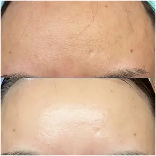 肌のお悩み改善サロン MELIA/朋美のエステ・リラクイメージ