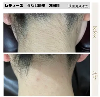 脱毛＆フェイシャル/ Rappore;増田のエステ・リラクイメージ