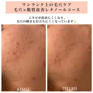 Bellesthe (ベルエステ)のエステ・リラクイメージ