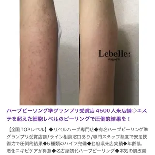 マツエク・マツパ 次世代まつげパーマは 『リベル名古屋』のマツエク・マツパデザイン