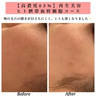 Bellesthe (ベルエステ)のエステ・リラクイメージ