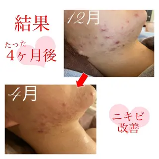 ショート カラー パーマ ヘアアレンジ メンズ キッズ ネイル マツエク・マツパ 金の糸脱毛 産毛ケア専門のエステ・リラクイメージ