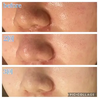 ロング カラー パーマ ヘアアレンジ メンズ キッズ ネイル マツエク・マツパ Ensor Clair所属・EnsorClair 代表 野口真央のエステ・リラクイメージ