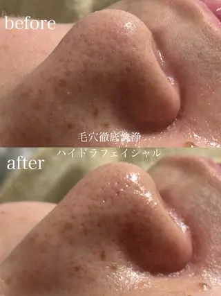 フェイシャルサロン CHIARA鈴木のエステ・リラクイメージ