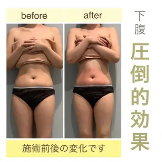 エステサロン JURISのエステ・リラクイメージ