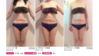 オレンジバナナ 県央店のエステ・リラクイメージ