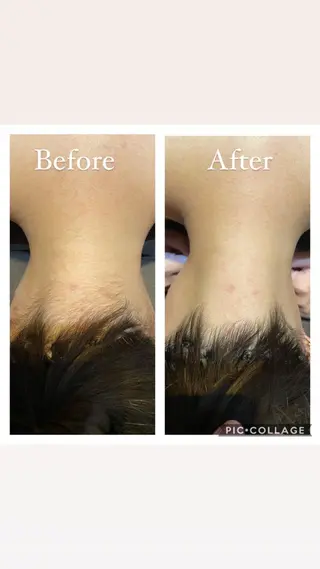 natura chuchuナトゥーラチュチュ所属・バスト体験 ナトゥーラチュチュのエステ・リラクイメージ