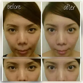 ミディアム ヘアアレンジ マツエク・マツパ 小顔矯正・美容鍼 美鍼堂のエステ・リラクイメージ