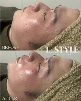 メンズ 【L_style.】 エルスタイルのエステ・リラクイメージ