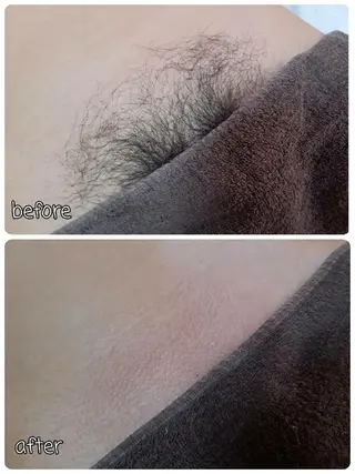 メンズ メンズ・脱毛サロン DEARS所属・山村幸久　メンズ脱毛 ディアーズのエステ・リラクイメージ