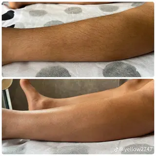 メンズ blue.💙【 脱毛&フェイシャル】のエステ・リラクイメージ