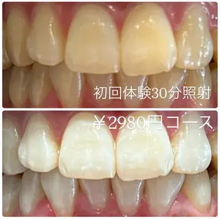 メンズ ホワイトニング ルーム　川崎店のその他イメージ