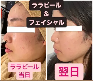 肌育・肌質改善サロン 🫧ニナル🫧のエステ・リラクイメージ