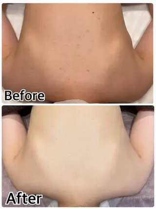 美肌脱毛サロン muroのエステ・リラクイメージ