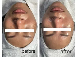 salon belle.sのエステ・リラクイメージ