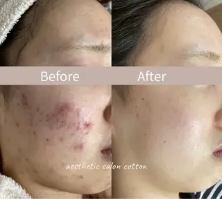 都度払い 肌質改善専門サロンのエステ・リラクイメージ