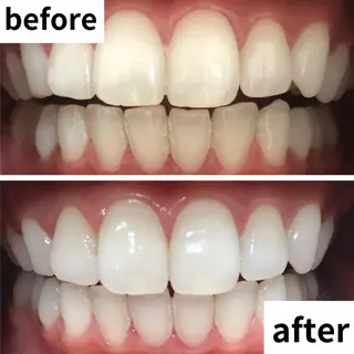 LBSホワイトニング 🌐渋谷店 河内のエステ・リラクイメージ